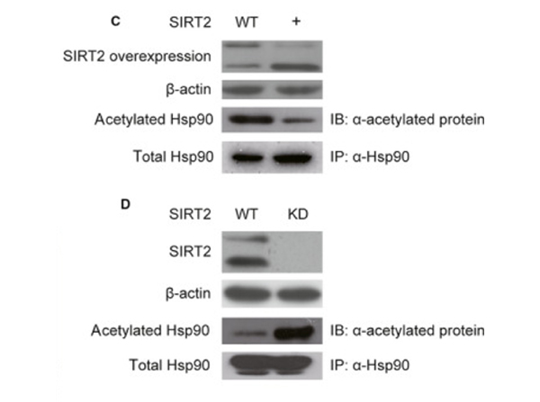 Immunoprecipitation using HSP90 K294ac